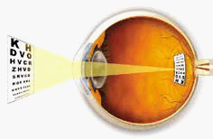 How an Image looks through the eye with Astigmatism